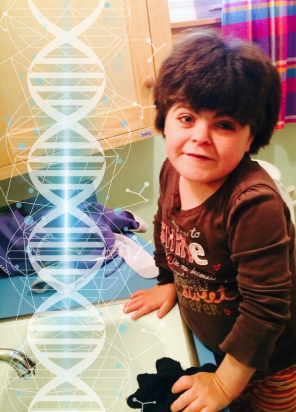 Recent Articles about CHOPS Syndrome leta